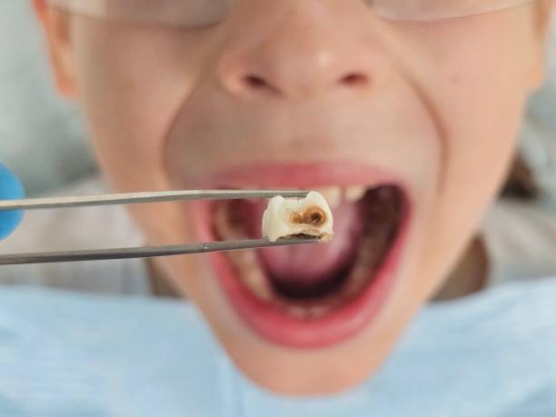 Best After-Hours Dental Trauma Care in Combine, TX